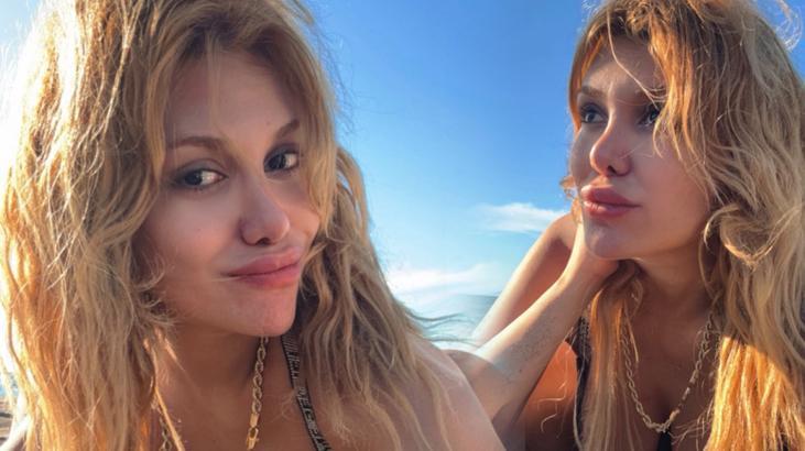 Survivor’da diskalifiye olmuştu! Almeda Baylan son haliyle görenleri şaşırttı