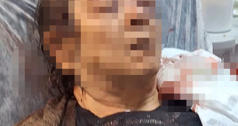 Konutta otururken tavandan kopan moloz yığını altında kaldı
